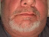 Grower72