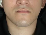 Ryan00